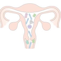 ivf4 ivf4